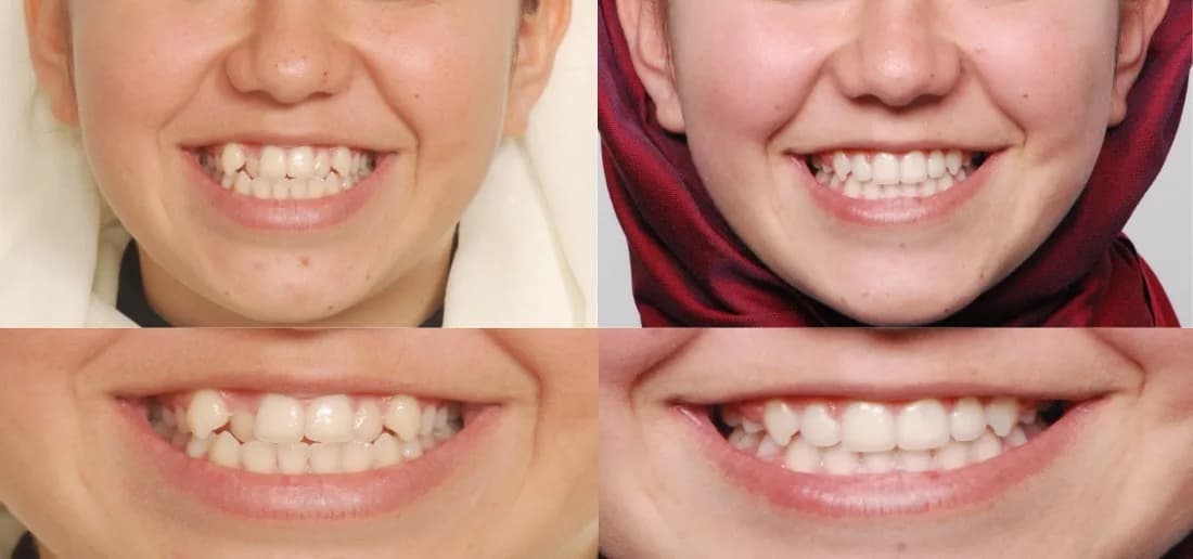 Dent Balat Diş Kliniği